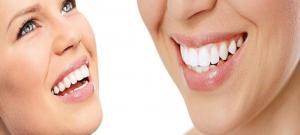 White Smile