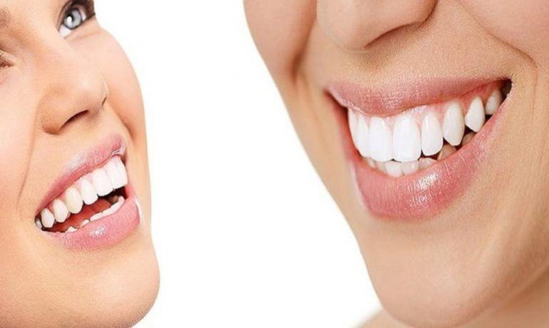 White Smile