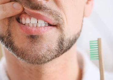 Addressing Bleeding Gums: Causes, Solutions, and When to Visit Creekside Dental
