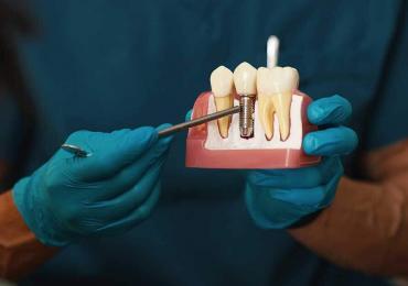 The Risks of Not Replacing a Missing Tooth