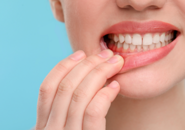 The Two Stages of Gum Disease: What Every Adult Should Know About Gingivitis and Periodontitis