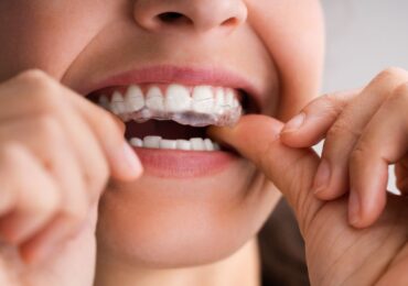 Gaps Between Your Teeth: What They Mean at Every Age in Buffalo Grove