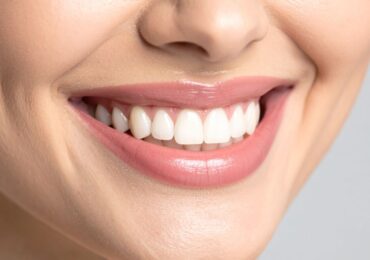 How to Get a Whiter Smile in Buffalo Grove: What Works and What Doesn't